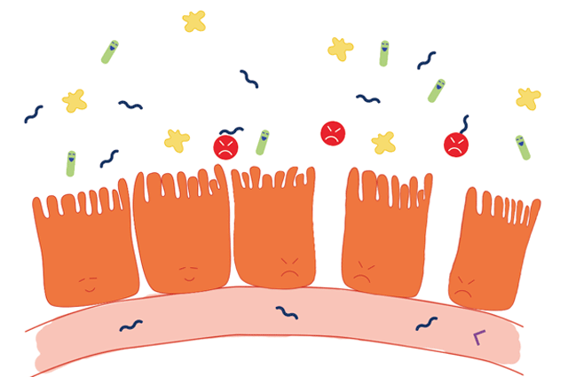 Con el intestino permeable, la mucosa de la pared intestinal ya no funciona como barrera y entran las toxinas como quieren al torrente sanguíneo Esto es lo que pasa cuando se tiene el intestino permeable